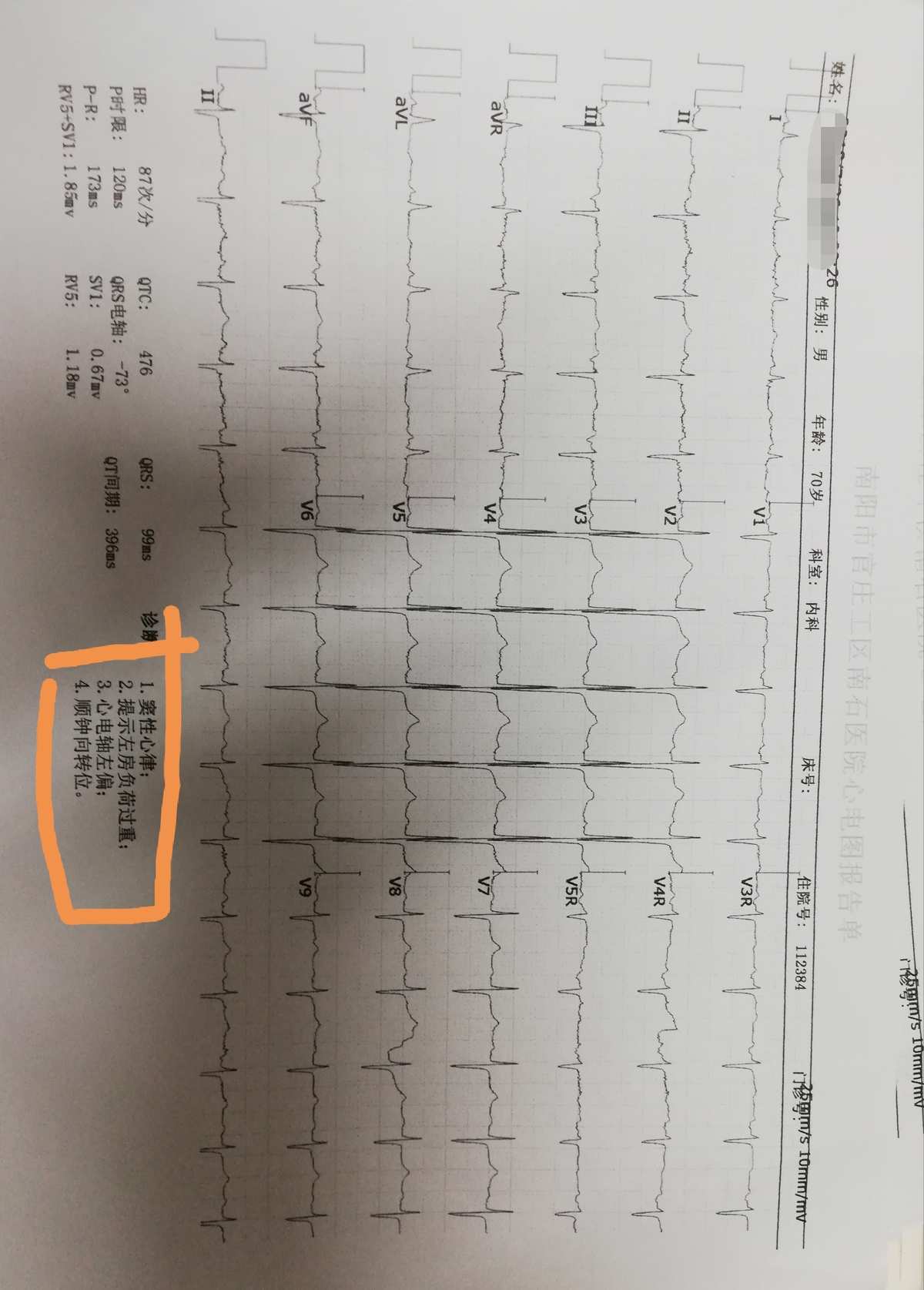 阵发心房扑动_阵发性室上性心动过扑_阵发性心房扑动吃什么药