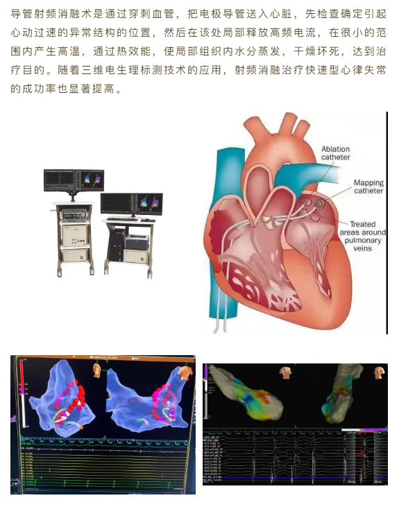 阵发性室上性心动过扑_性之图吧发布性之图吧夜上青楼_尸毒过木阵