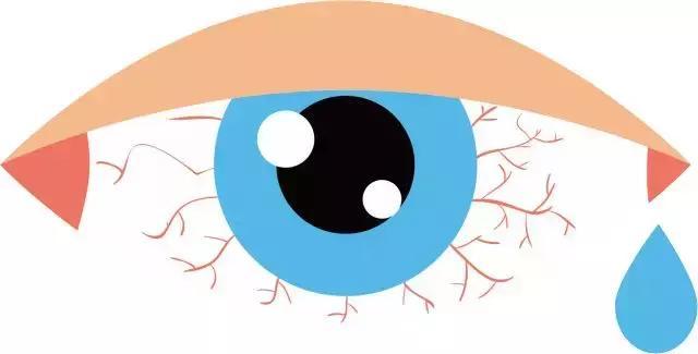 眼睛痒看手机特别痒_打手机游戏眼睛痒怎么回事_眼睛痒是手机看多了吗