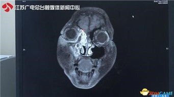 泡泡大作战游戏手机游戏 